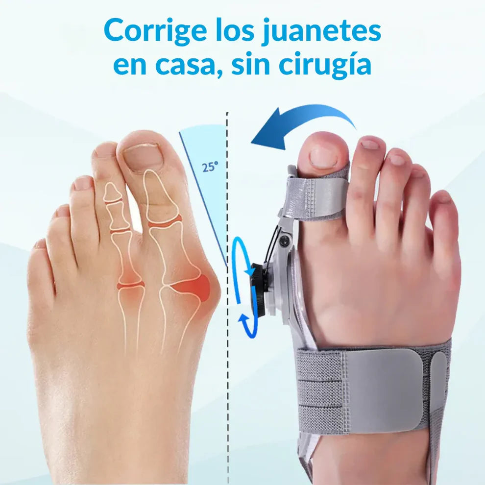 Orthomia™ - Corrector articular de juanetes
